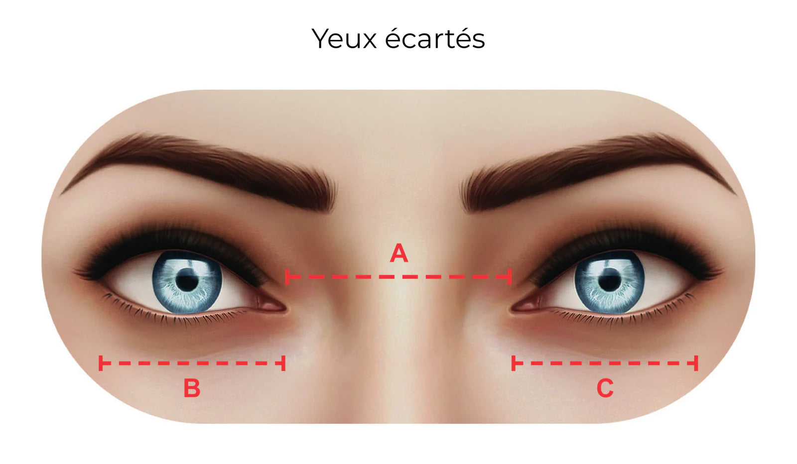 Yeux écartés