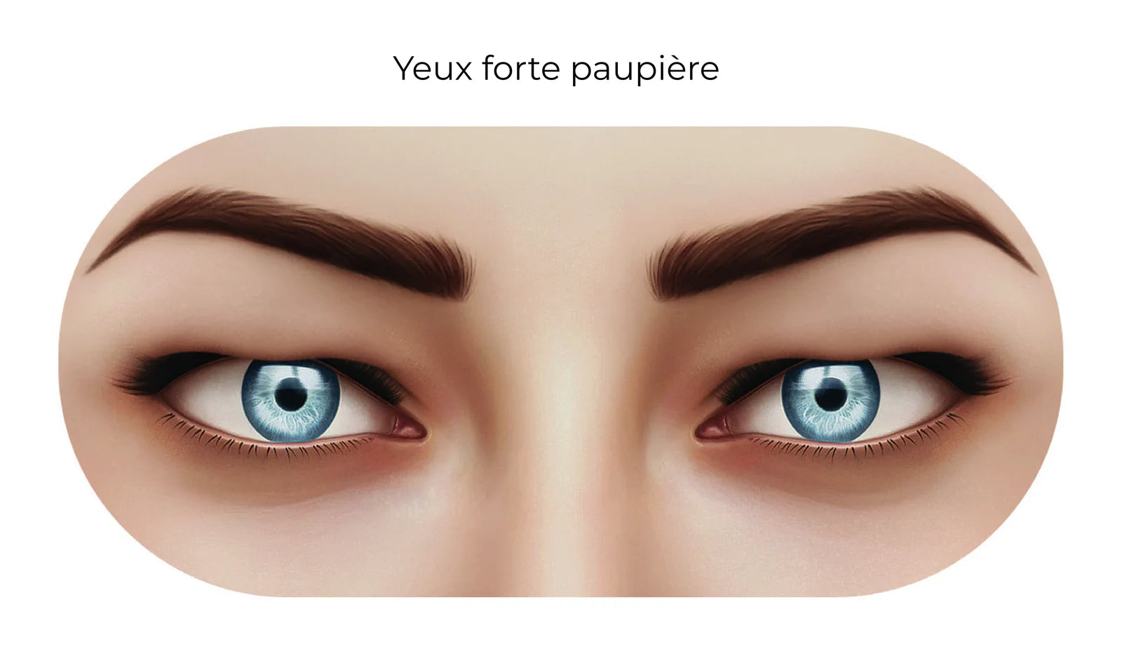 Yeux à forte paupière
