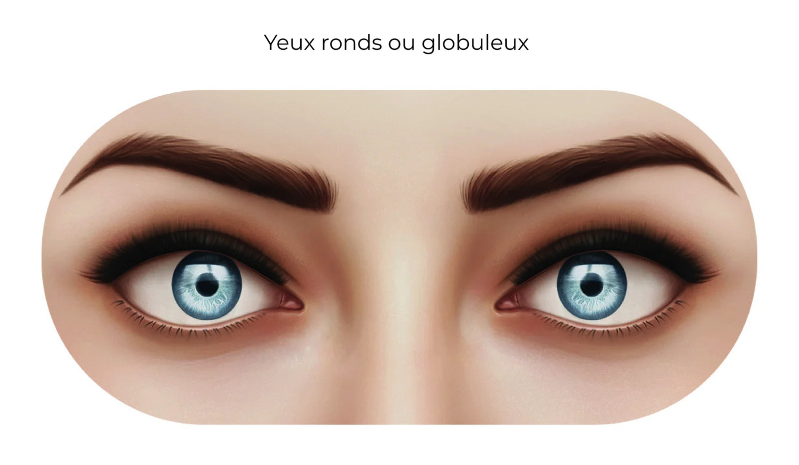 Yeux ronds ou globuleux